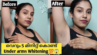 🩸Live Result 🩸Result കണ്ട് ഞെട്ടാൻ Ready ആണോ 😱💯 Under arms whitening home Remdies malayalam [upl. by Fifi]