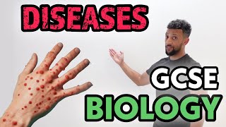 GCSE Biology  Infectious Diseases Rap [upl. by Adriaens]