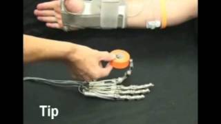 Vanderbilt MultiGrasp Hand Prosthesis [upl. by Ylellan]