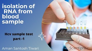 How to isolate RNA from blood plasma sample  HCV test  part  1  RNA extraction [upl. by Xylon439]