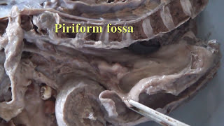 Anatomy labMedian Section of Head and Neckcadaver specimen by DrGosai [upl. by Aihsetel]