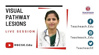 Paramedical Course ∣ LIVE Class ∣ Visual Pathway Lesions [upl. by Irec]