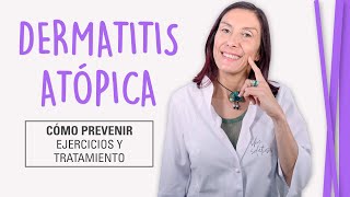 Dermatitis Atópica  Cómo Curar la Piel Atópica [upl. by Nitsreik]