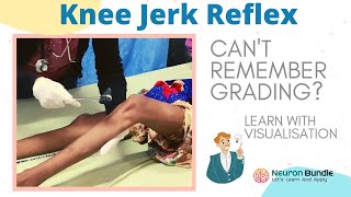 knee jerk reflex I all 4 grades with demo on patients I brisk tendon reflex rootvalue I neurology [upl. by Zora748]