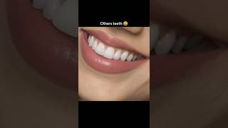 Others teeth😬🤖 teeth viralshort viralvideo ytshorts [upl. by Eesdnil]