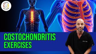 Costochondritis Exercises [upl. by Stephenie]