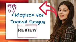 Ciclopirox For Toenail Fungus  Review [upl. by Aziram524]