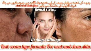 Best cream formula for neat and clean skin15 days callangeKOMAL beauty voice [upl. by Yelsgnik]