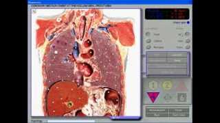 3D NLS Health Diagnosis and Treatment Computer System [upl. by Ayekahs]