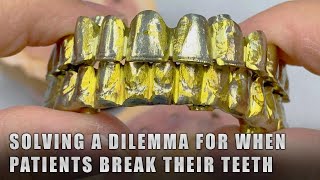 Solving a Dilemma for when Patients break their Teeth [upl. by Annehs]