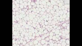 Shotgun Histology Adipose Tissue [upl. by Raasch]