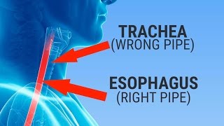 What happens when you swallow something down the wrong pipe [upl. by Browning]
