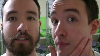 Shaving My Beard 1mm At A Time [upl. by Ellened]