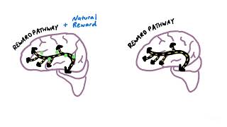 How an Addicted Brain Works [upl. by Tterab334]