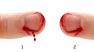 clotcoagulate ASL [upl. by Nalloh413]