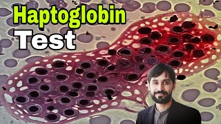 Haptoglobin Test  Haptoglobin Blood Test  MLT Hub with kamran [upl. by Dowlen]