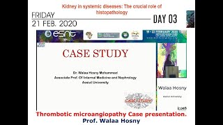 Thrombotic microangiopathy Case presentation prof Walaa Hosny [upl. by Kendrah194]