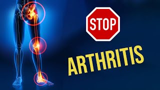 Exercises For Arthritis While Sitting Easy Effective [upl. by Aneekahs]