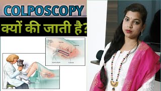 Colposcopyकॉल्पोस्कोपी क्या है  Colposcopy Test in Hindi [upl. by Atrebor148]