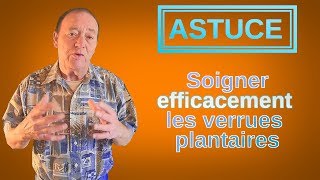 ASTUCE  Extraire EFFICACEMENT une verrue plantaire [upl. by Niobe]