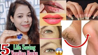 5 Super Amazing Everyday Vaseline Hacks For Every Girls 😍✅ [upl. by Iverson]