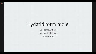 Hydatidiform Mole  Tutorial  Pathology [upl. by Yleme]