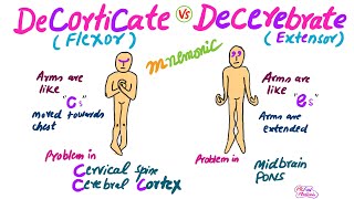 Decorticate Vs Decerebrate RigidityMnemonic for USMLE [upl. by Eve]