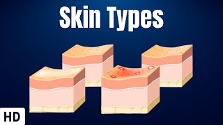 Skin Types Everything You Need To Know [upl. by Kronfeld638]