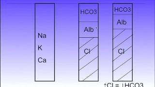 Practical Approach to Metabolic Acidosis Part 2 of 4 [upl. by Nnasus310]