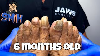 LONG TOENAILS CUTTING TRANSFORMATION [upl. by Myrtle]