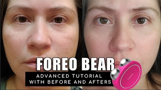 FOREO BEAR  BEFORE amp AFTERS ADVANCED TUTORIAL AND TIPS TO GET THE BEST RESULTS [upl. by Cida]