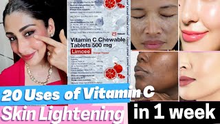 20 Benefits of Vitamin C for Skin  Limcee Vitamin C tablet for Skin remove Tan dark spots Melasma [upl. by Annawoj]