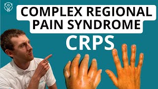 CRPS 101 Everything You Need To Know  Aleks Physio [upl. by Ariaec618]