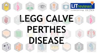 Legg Calve Perthes Disease [upl. by Hna]