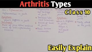 Arthritis  Osteoarthritis  Rheumatoid  Gout  Class 10 Biology UrduHindi [upl. by Queenie]