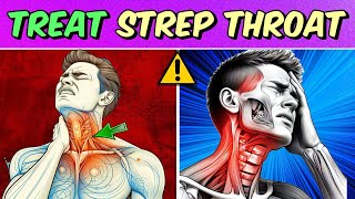 How to treat strep throat infection Home remedies for strep throat [upl. by Suzzy]