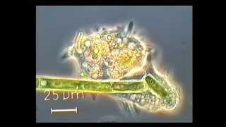 Amoeba eating a green algae [upl. by Acinhoj]