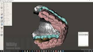 Planmeca Romexis Occlusal Guard [upl. by Rashida]