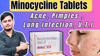 Minocycline Hydrochloride Tablets usp  Best Antibiotic For Acne amp Pimples  Benifit Of Minocycline [upl. by Ydieh]