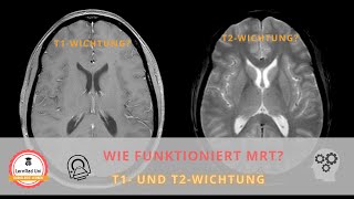 Wie funktioniert MRT T1 und T2 Wichtung [upl. by Mirabel]