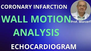 Three rules to analyze LV segmental contraction [upl. by Idnaj]