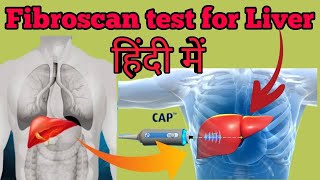 What is Fibroscan Test for Liver Explained in Hindi  Use Price and Normal Range [upl. by Elvyn684]