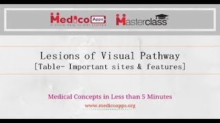 Lesions of Visual Pathway Table Important sites amp features [upl. by Fidel596]