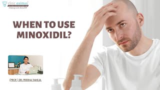 When to Use Minoxidil [upl. by Adnarom237]