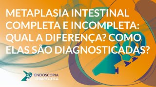 Metaplasia intestinal completa e incompleta qual a diferença Como elas são diagnosticadas [upl. by Schellens]