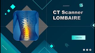 Démonstration CT Scanner LOMBAIRE  Partage de pratique [upl. by Weisberg]