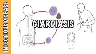 Giardiasis  Giardia Lamblia Giardia intestinalis Giardia duodenalis infection [upl. by Arnaldo]