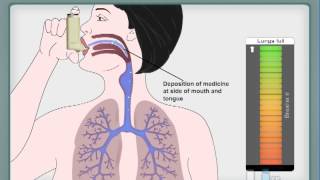 How to use Asthma inhaler  MDI [upl. by Ethelinda3]