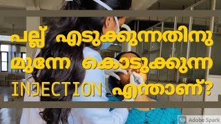 Local Anasthesia for tooth extraction  Explained in Malayalam  Dr Anagha Cheleri [upl. by Ynwat]