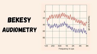 Bekesy Audiometry  Very Easy [upl. by Odnumde]